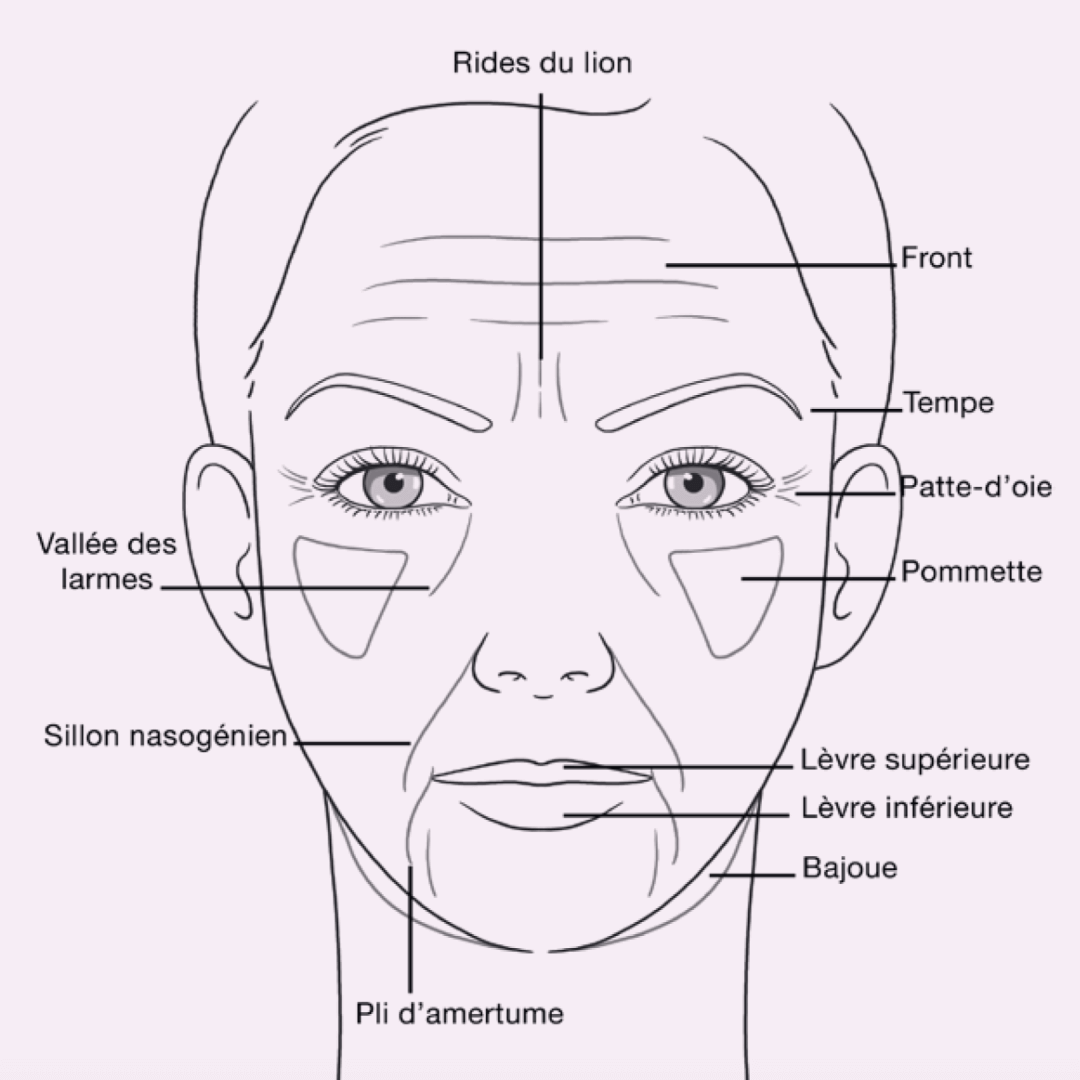 Rides du visage dessin